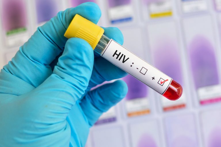 Почему тест на ВИЧ  должен пройти каждый